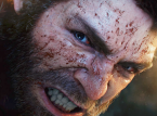 Marvel's Wolverine attore ha studiato cani rabbiosi per interpretare un Logan più selvatico